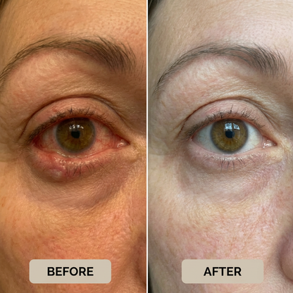 ClaraWand™ by Eyecanta